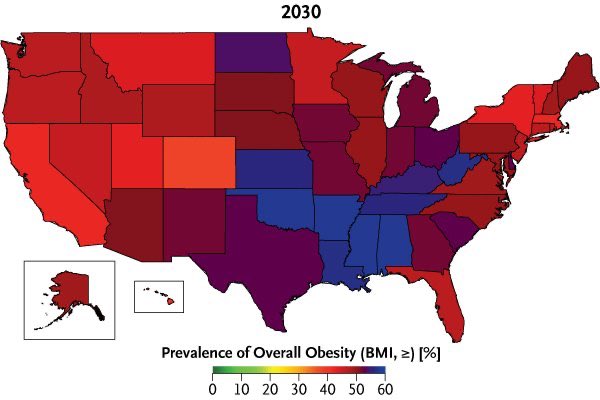 almucastro01's tweet photo. Tremendos los datos de previsión de obesidad en USA de este artículo del @nejm  “Projected U.S. State-Level Prevalence of Adult Obesity and Severe Obesity” Incremento también de las diferencias por estrato demográfico  https://t.co/xryfSxnEfh https://t.co/1qNfZeWYVT
