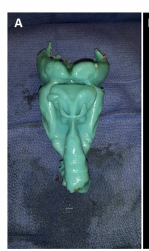 disfagiabr's tweet photo. Three‐dimensional analysis of the human pharyngoesophageal sphincter https://t.co/LgFzorYehe https://t.co/mZlPNeyxuM