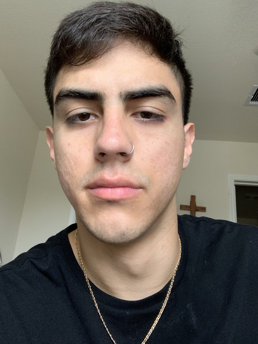 gabriiel_suarez's tweet photo. I’m not going to make this sad or sappy I’m just happy. lol This was my skin back in may this year. I was going through a lot at the time, but I’m better now. I’m glad to be comfortable in my skin now. Stay the course and you’ll be straight!! #acutane https://t.co/yD1Q99eAJr