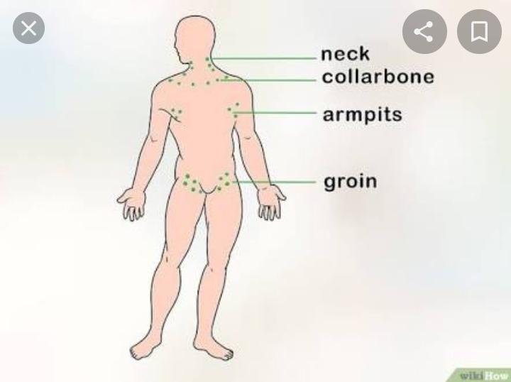 как проверить лимфоузлы. надключичные лимфоузлы расположение схема. лимфатические узлы на теле человека схема у мужчин. лимфатические узлы на теле человека схема расположения у женщин. расположение поверхностных лимфатических узлов у человека.