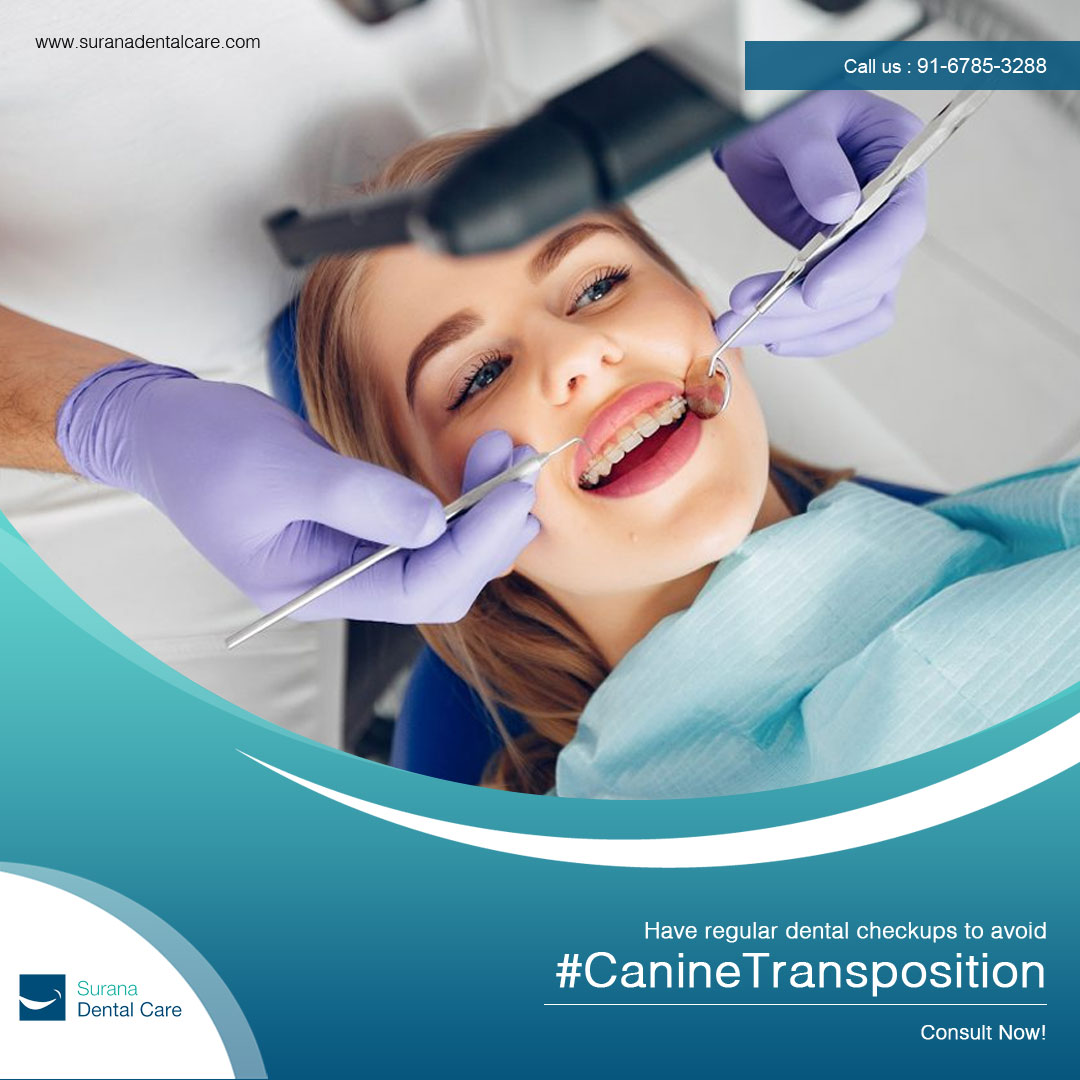 CareSurana's tweet photo. Have regular dental checkups to avoid #CanineTransposition. It’s a condition which causes a severe pain and  deep cavity.
Know more about Canine Transposition visit  https://t.co/A230vOYZWk

#Cuspids #molar #premolar #Canine #teethset #dentist #oral #whiteteeth #shinyteeth https://t.co/9MVakl0eA9