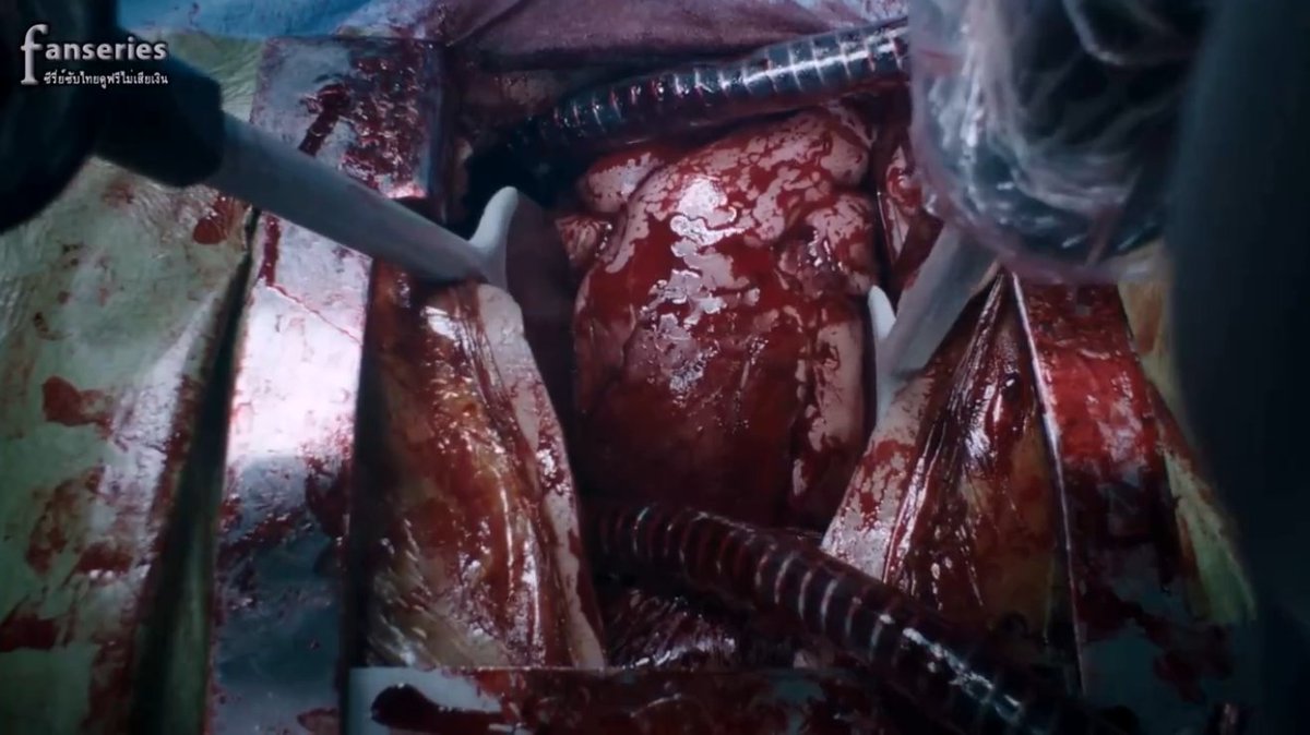 SubthaiS's tweet image. The Resident Season 3 ซับไทย Ep.10
(ดูลิงก์หลักไม่ได้ก็ลองดูลิงก์สำรองนะครับ)
คลิ๊ก &amp;gt;  fanseries.co/the-resident-s…

#TheResident #TheResidentSeason3 #TheResidentSS3 #TheResidentSS03
#SubthaiSeries
#ซีรี่ย์ฝรั่ง2018 #ซีรี่ย์ฝรั่งซับไทยพากย์ไทย