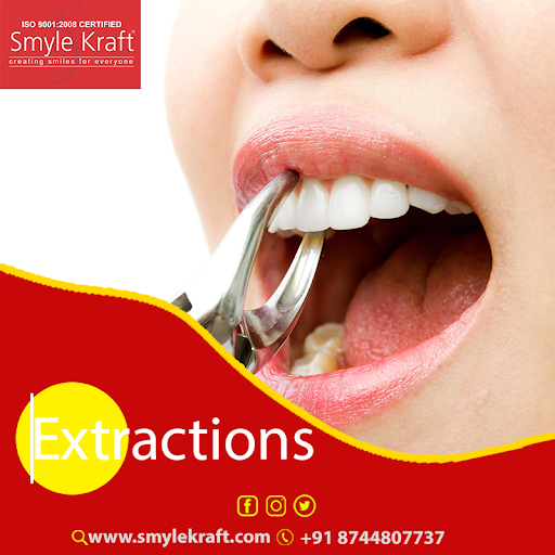 Are you faced with empty spaces between your tooth?Smyle Kraft will treat dental extraction to remove the space between your teeth.
Get Contact : 087448 07737
Visit us :smylekraft.com
#dentalextraction #greater #noida #treatment #dentist #bestdentistnearme #dentistnearme