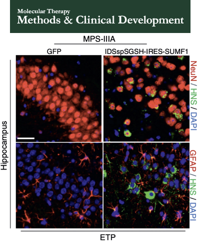 Tigem_Telethon's tweet photo. Congratulations to Cristina Sorrentino @cristinasorr and Fraldi’s group for the publication on @MolTherapy
Her work is of crucial importance for the therapeutic treatment of #MucopolysaccharidosisIIIA #MPSIIIA @CellPressNews #TigemScience
Read more here https://t.co/r7rh6iobm0 https://t.co/nM1tklDNqm