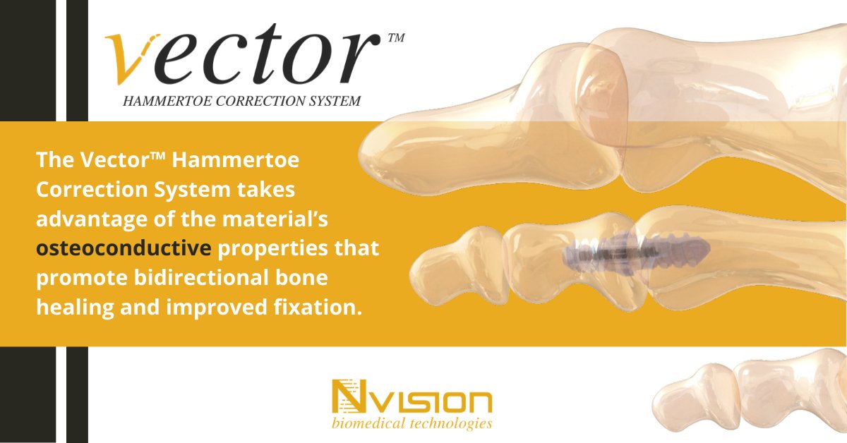By utilizing the PEEK-OPTIMA® HA Enhanced, the Vector™ Hammertoe Correction System takes advantage of the material’s osteoconductive properties that promote bidirectional bone healing and improved fixation. Contact us to learn more. bit.ly/2LNjcBo #PEEK #Vectorhammertoe
