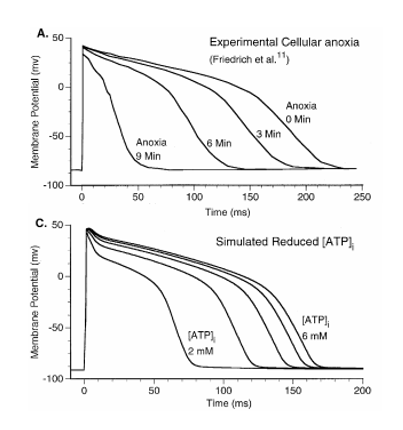 6/This decrease in ATP production leads to more potassium export through K-ATP  faster ventricular depolarization of ischemic cells relative to healthy onesa shorter cardiac cycle.  Https://physiology.org/doi/full/10.1152/physrev.1999.79.3.917