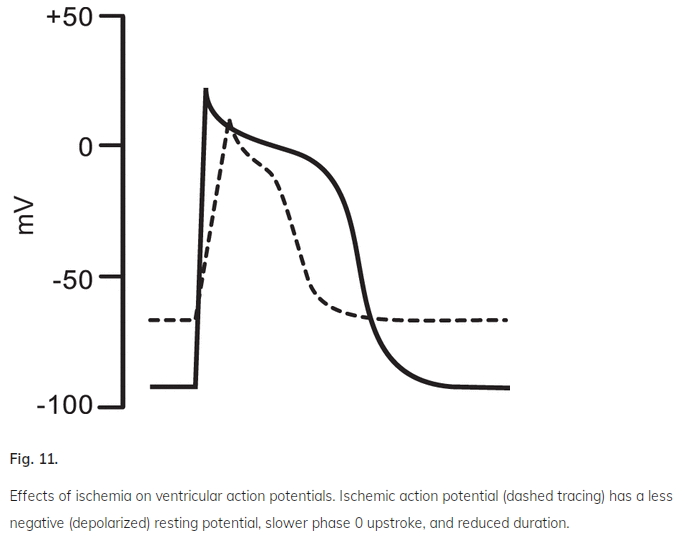 7/Here's another way to view the shorter ischemic electrical cycle.  https://www.physiology.org/doi/full/10.1152/advan.00105.2016