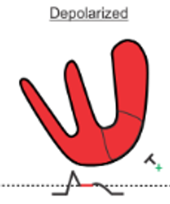 9/Conversely, there is little difference between ischemic/non-ischemic depolarization speeds. Thus the voltage gradient disappears during the QRS complex and the EKG returns to isoelectric baseline in the ST segment (aka zero voltage).  https://bit.ly/2s99b9l 