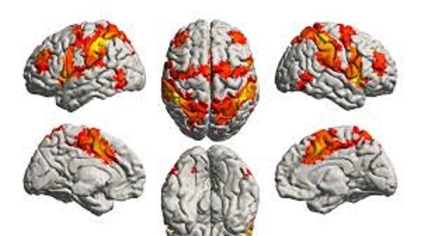 HealthPost2's tweet photo. Study: Memories of music cannot be lost to Alzheimer’s and dementia https://t.co/MHCCOqKi9z https://t.co/m37kTXNGSq
