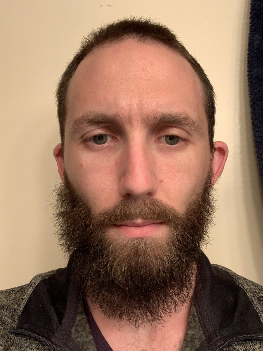joshflashnz's tweet photo. Whats this? Oh just me, my lazy eye, some messy hair AND MY BLOODY UNEVEN BEARD - not gonna oust the barbershop, just thought you all might want to enjoy the bangup job.
#barber #shaversregret #shouldhavechecked #skills #brofessional #uneven #LastBeardStanding #beard #lazyeye https://t.co/FuJOYv2Dpv