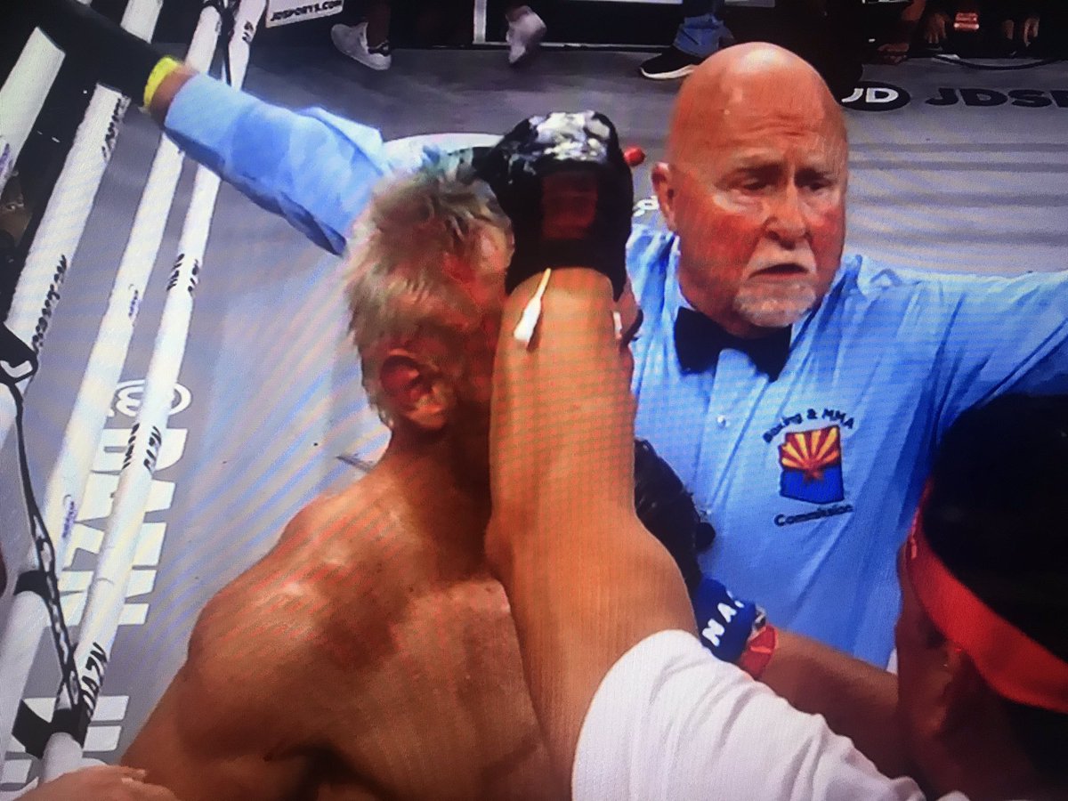 julianisjulius's tweet image. Se acabó!! Chávez dijo “no más”. 
Jacobs le rompió la nariz con un upper y le abrió la ceja con derechazo, y tiran vasos al ring