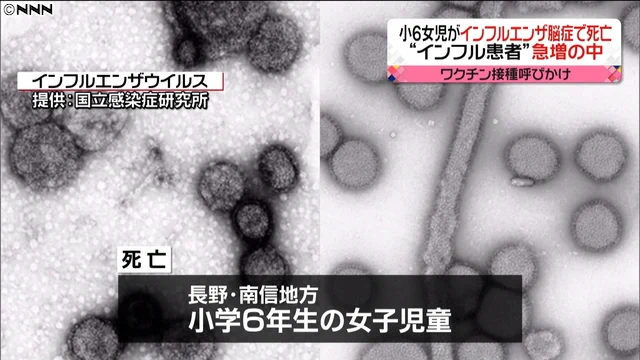 長野県の小学生がインフルエンザ脳症で死亡、県はワクチン接種を呼び掛ける！