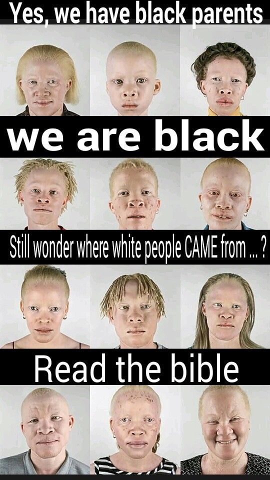 EisheroMarley's tweet photo. #Albino #Negroes #Yisraelites #Blacks #Shem #Hebrews #Israelites #SeedsOfJacob #ChildrenOfYisrael 

Do You Ever Wonder Where Or Who #Esau #Edom #Idumea aka #CaucasianWhites Generate From?? #CainBackOnTheEarth #Genesis25v19to34 #WhosRedAndLeprous https://t.co/Utj3P77fsc