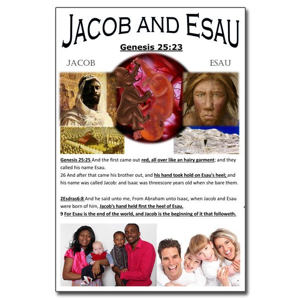 EisheroMarley's tweet photo. #Albino #Negroes #Yisraelites #Blacks #Shem #Hebrews #Israelites #SeedsOfJacob #ChildrenOfYisrael 

Do You Ever Wonder Where Or Who #Esau #Edom #Idumea aka #CaucasianWhites Generate From?? #CainBackOnTheEarth #Genesis25v19to34 #WhosRedAndLeprous https://t.co/Utj3P77fsc