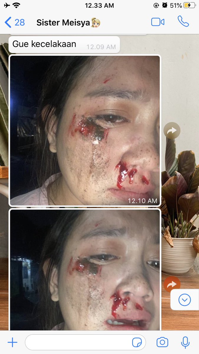 rivanfhrza's tweet photo. Hallo @gojekindonesia barusan kakak saya ngabarin klo dia kecelakaan tapi malah ditinggal kabur sama gojeknya. Tolong dong untuk lebih bertanggung jawab. Ini kecelakaan loh kok seenaknya aja main ditinggal kabur. Tolong drivernya di tindak lanjuti https://t.co/qsJSO7drr3