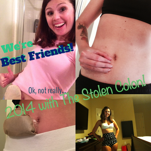 My favorite posts from 2014 ostomy.me/1wbtl79 #ostomy #ibd #repost