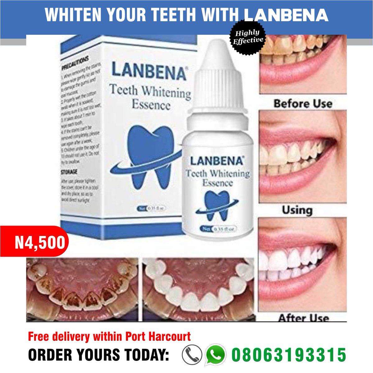 omnicoded's tweet photo. Whiten your teeth with LANBENA. Order now; 08063193315
#WhiteTeeth
#Lanbena https://t.co/y5ndqaToP2