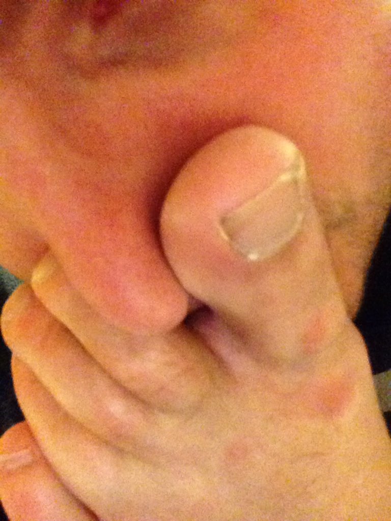 Footboy2017's tweet photo. My feet smell amazing. https://t.co/sk6oTrVXuK