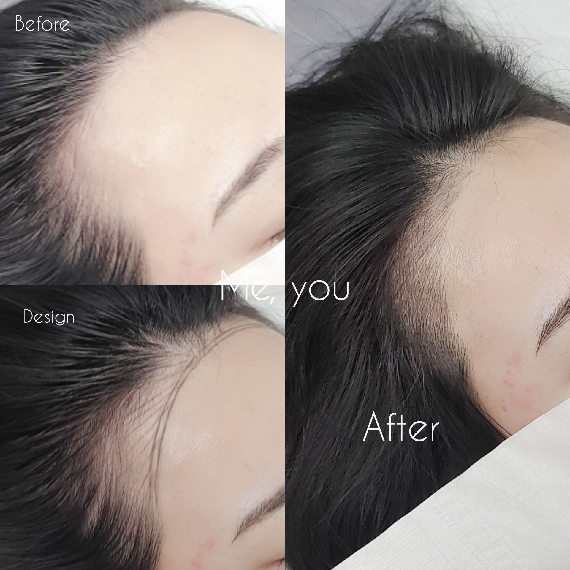 Meyou Brow A Twitter 6dヘアライン 施術 生え際のうぶ毛部分に沿ってナチュラルに1本ずつ描き入れます カウセリングから施術まで2時間半 3時間しっかりお時間を取って施術致します お問い合わせは Meyou Browまで 韓国アートメイク アートメイク