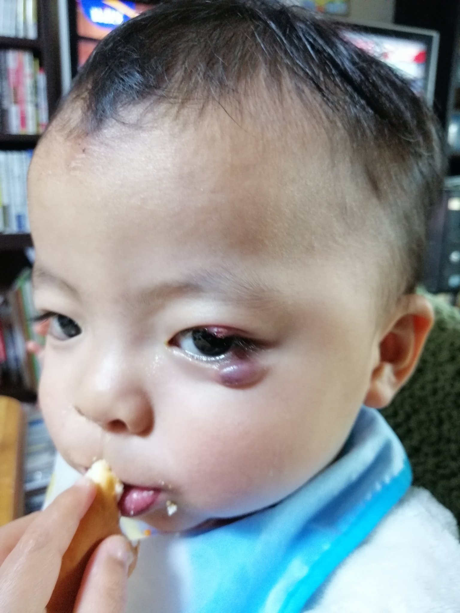 愛甲昌信 Itと動画を使いこなす達人 知ってる人いたら教えてください 数カ月前から目の下が腫れてて 病院行っても異常がない言われてます この腫れがなんなのか 知ってる人はお願い致します T Co Lh7ijnbaqp Twitter