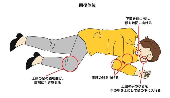 回復体位のtwitterイラスト検索結果 古い順 回復体位のtwitterイラスト検索結果 古い順