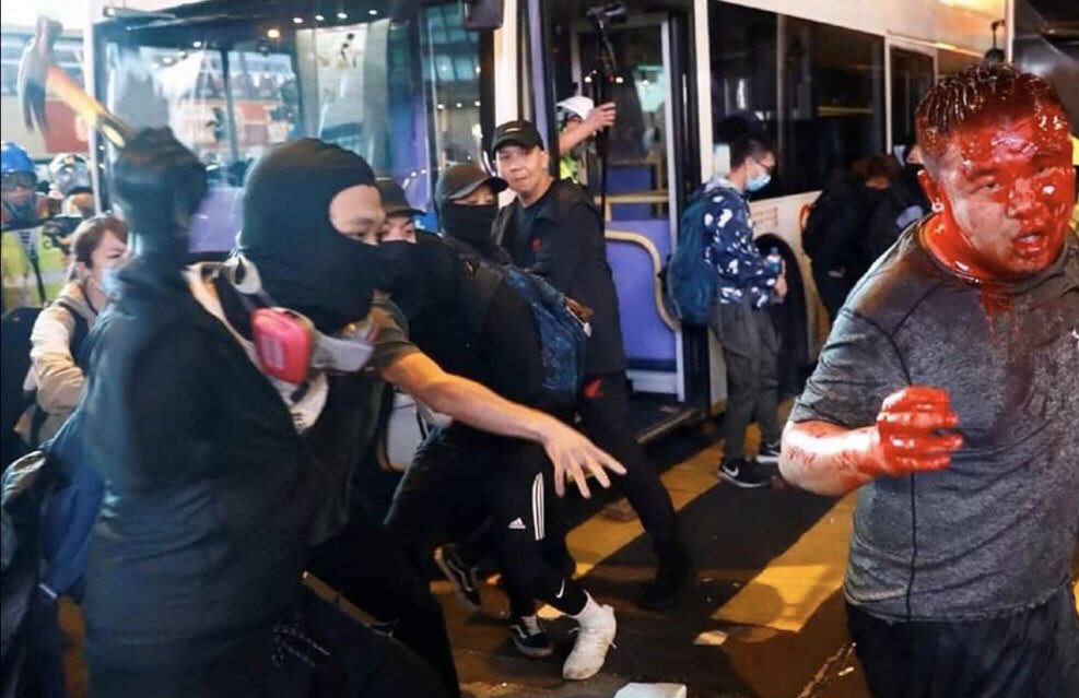 AwakeningHK's tweet photo. @SolomonYue @hkpoliceforce May conscience be with you.
No #HKProtesters , but #HKTerrorist . https://t.co/vNfzvKUGXv