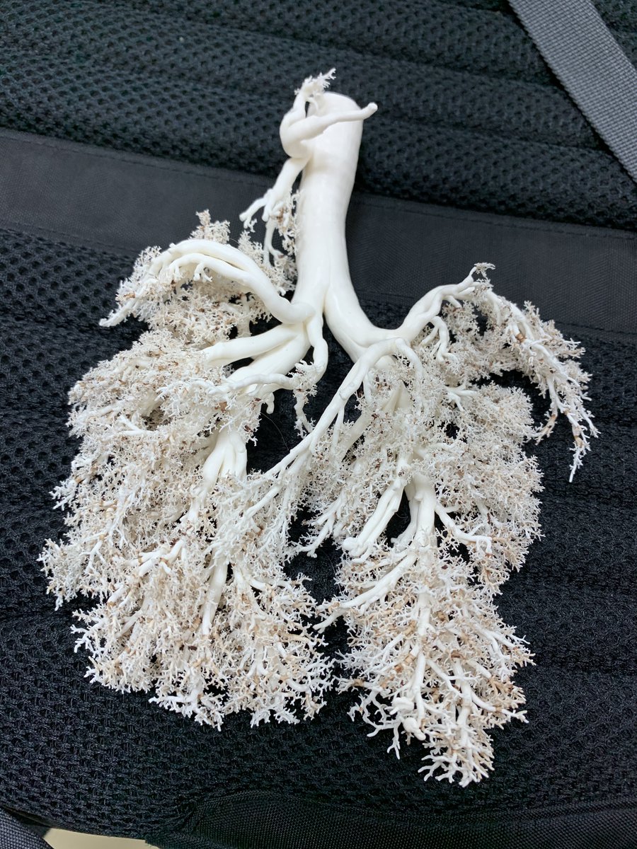 IES_LAS_SALINAS's tweet photo. Modelo en 3D de silicona de un árbol bronquial de cordero realizado por alumnos 1º bachillerato @IES_LAS_SALINAS #anatomía #prácticasdebiología https://t.co/1UKy8ItW0d