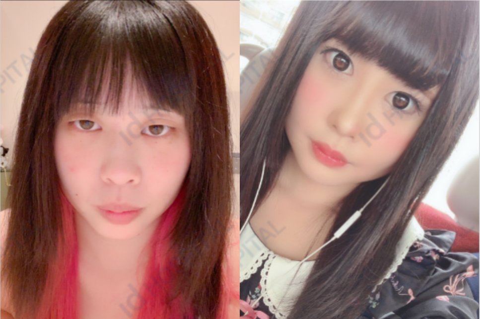 idhospitalkorea on Twitter "Japanese patient's list of surgeries