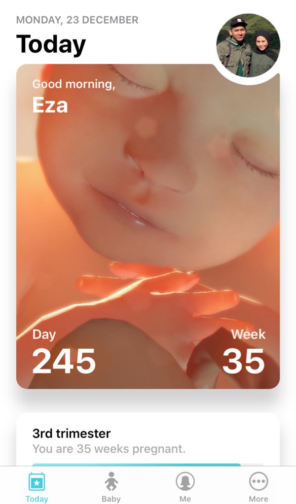 EzzaSarbini's tweet photo. Jangan gelabah, jangan takut, jangan nangis. Semuanya akan ok kan? #35weekspregnant #nervousteruk #countingweeks https://t.co/6a6AjKQAIk