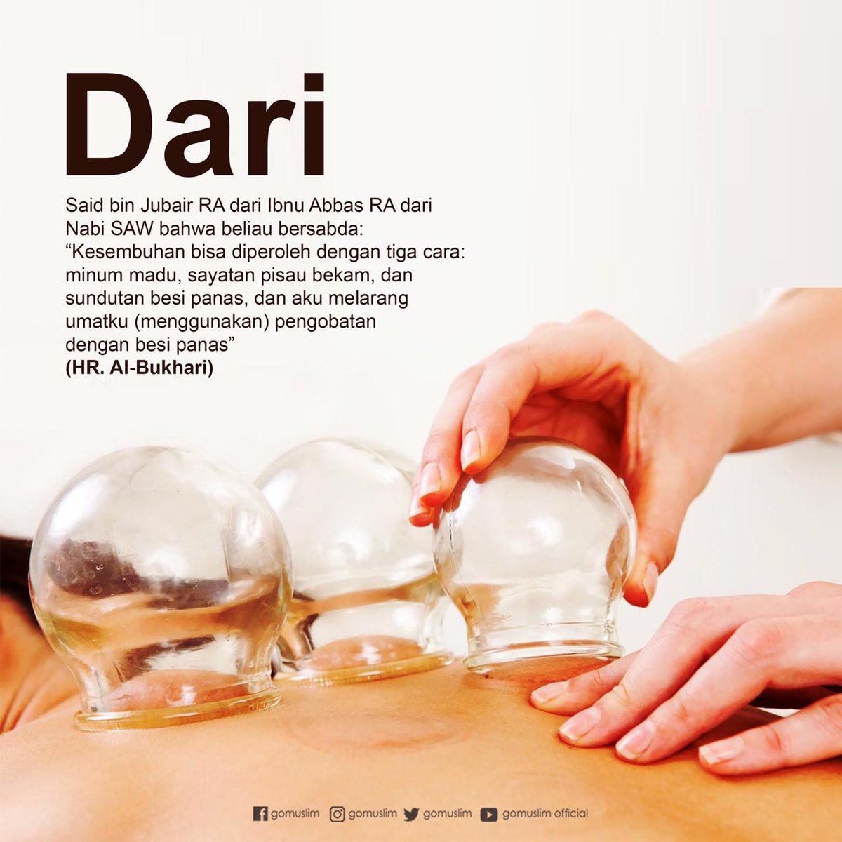 gomuslim's tweet photo. Kesembuhan bisa diperoleh dengan tiga cara: minum madu, sayatan pisau bekam, dan sundutan besi panas, dan aku melarang umarku (menggunakan) pengobatan dengan besi panas." (HR. Al-Bukhari) #gomuslim #dakwahislam #infoislam https://t.co/7WUJPLyukW