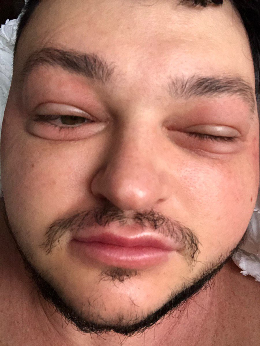 nocontext_thief's tweet photo. 31 декабря / 1 января https://t.co/9OGHfQ5vPF