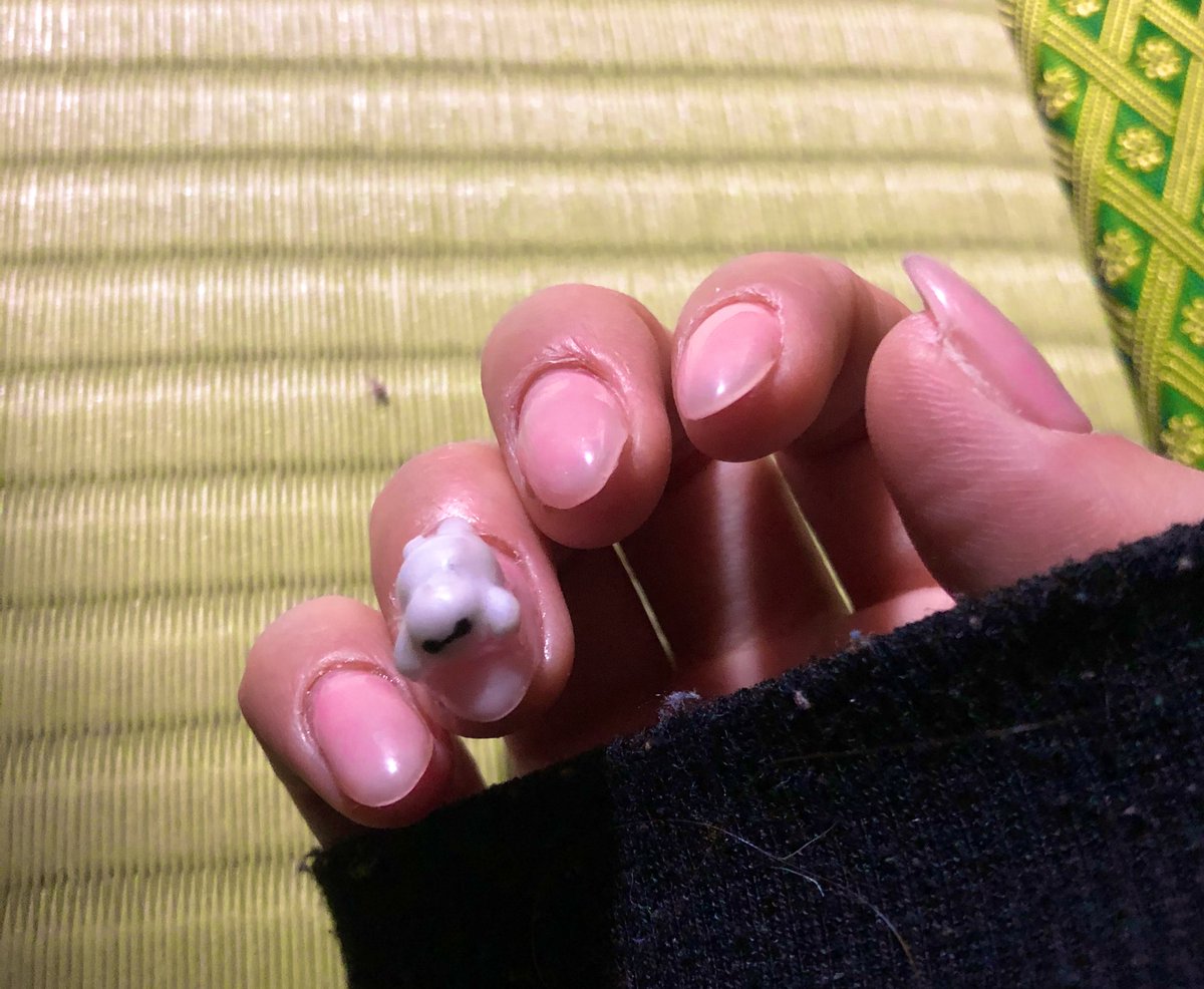 ネイルアレルギー