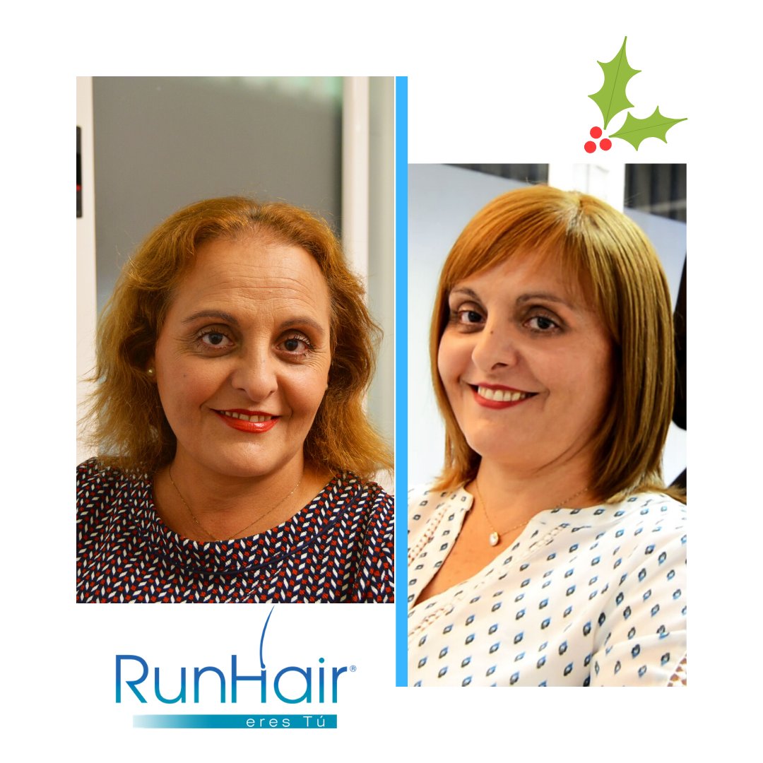 centrocapilarRH's tweet photo. En 2020 puedes tener el volumen de cabello deseado, sin rapar entrelazando la prótesis capilar con tu cabello. Atendemos con total discreción y ¡Feliz Navidad! ... 👩💪🤩 @RunHair
#runhair #protesiscapilares #tratamientocapilar #calvicie #diciembre2019 #alopecia #navidad2019 https://t.co/h5HMHZmAcQ