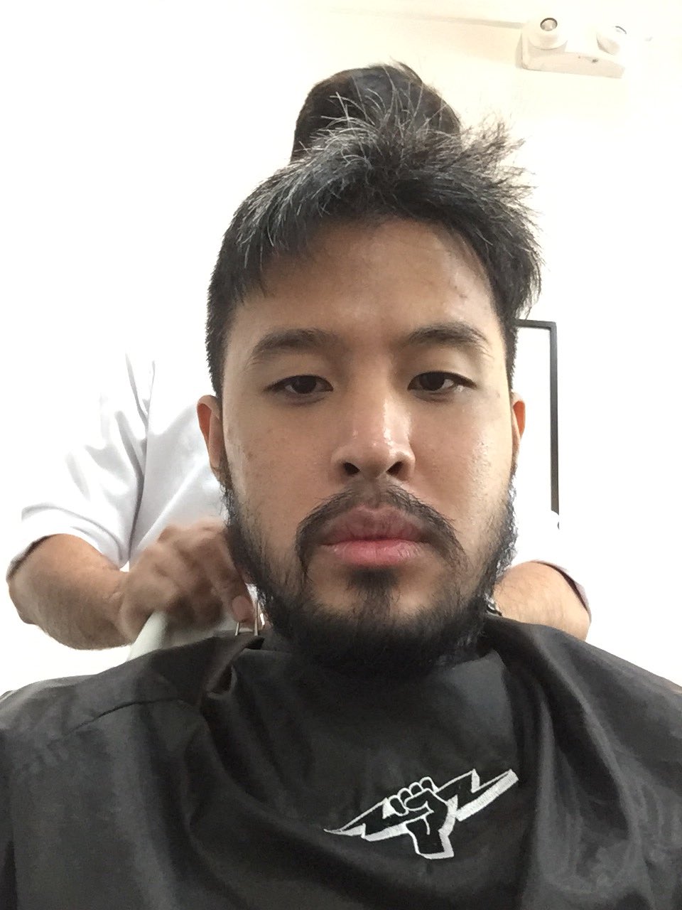 Featured image of post Minoxidil Beard Before And After Asian Sometime after minoxidil got so popular in underground beard circles researchers from thailand decided to test it in a clinical environment4