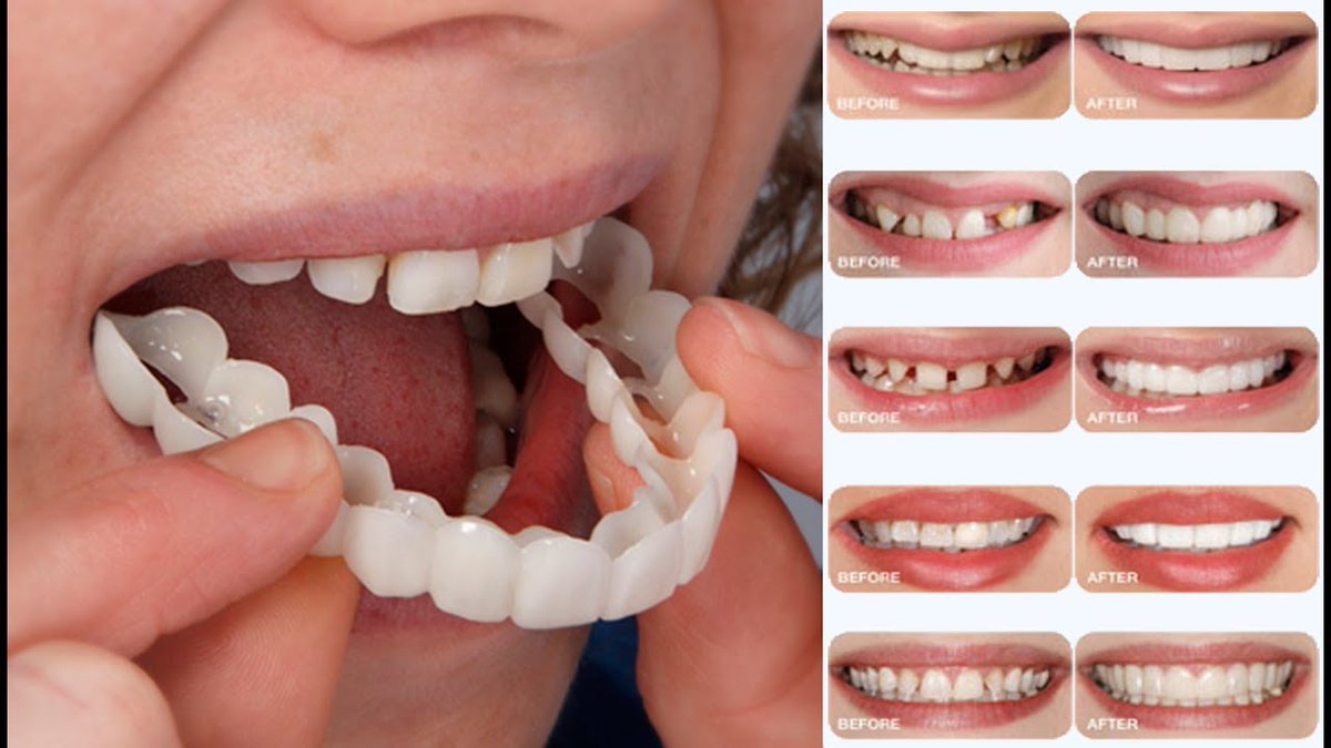 JakeSumms's tweet photo. 🍂ابتسامة هوليود🍂  
🦷-سهولة الاستخدام 
🦷-لا تحتاج الى حفر أو ألم أو تخدير لسنان
🦷-تعدل على الأسنان

ضمان لمدة سنة .
معنا ابتسم بثقة ✅
...
للطلب رابط الواتس اب في اول تعليق

#سًًنًًابًًًيًًً 
سكس فون
#معًصًًيتًًًيً_رlحتًًًيًًُ
فويس
سادي
فحل
قحبه
عنيف
زب كبير
كسي
سالب
sex
نيك https://t.co/RiDiprGaYH