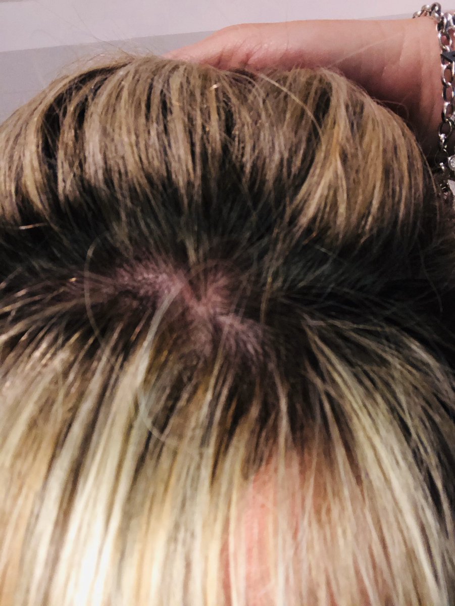 xxxzukixxx's tweet photo. Just had full head #Highlights Do you think #hairdresser forgot the #hairdye for #fullhead #blonde it is most definitely not! Didn’t let her do my #christmashaircut 😢 https://t.co/km6CCvcCOc