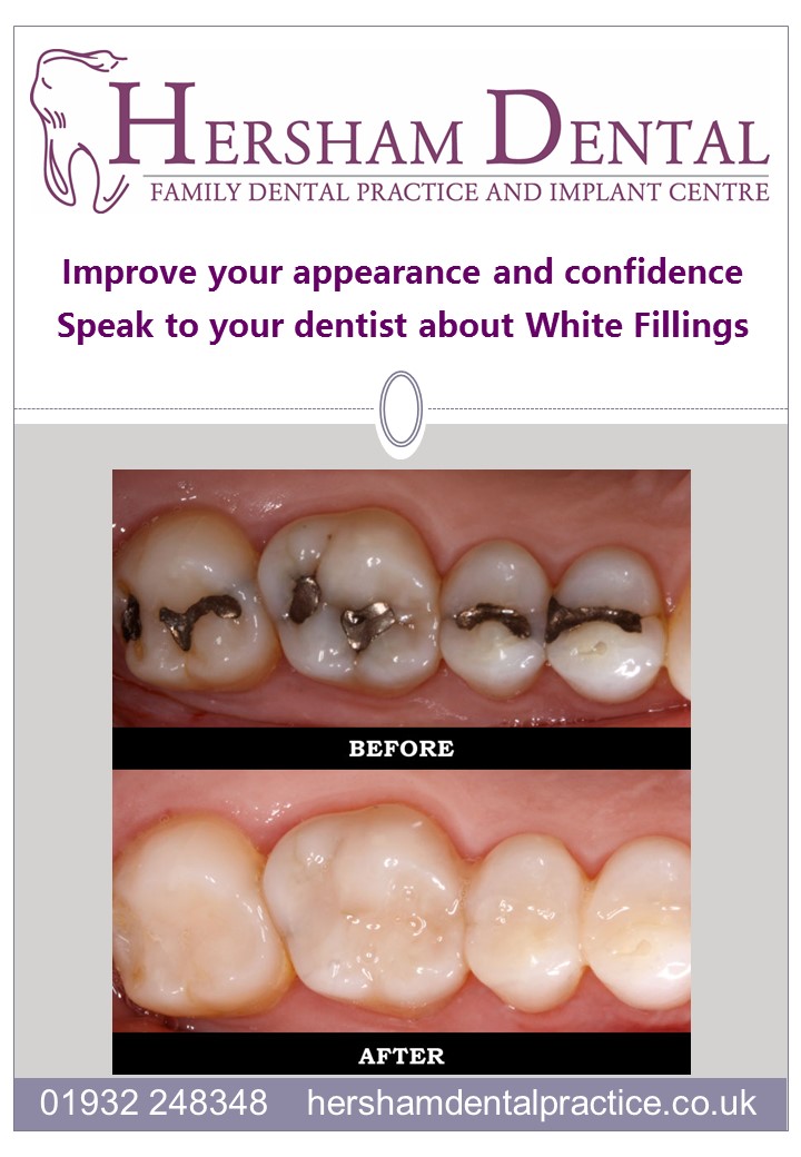 Hersham Dental (@hershamdental) on Twitter photo 