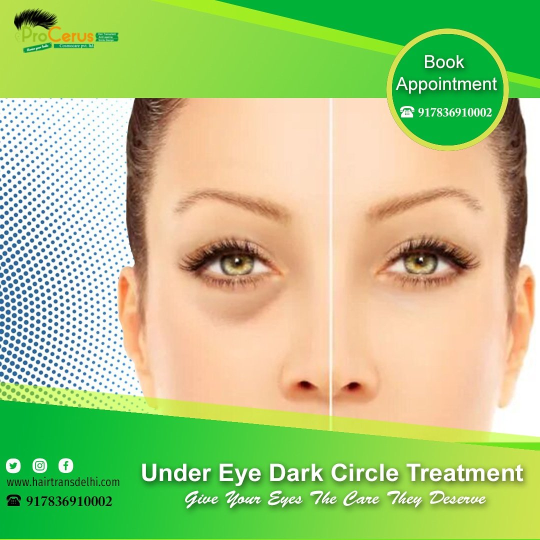 ProcerusClinic's tweet image. Treat Shadows Under Your Eyes by Skin Treatment Experts in Delhi Kalkaji.

Book +917836910002

or Enquire at lnkd.in/f32nYTN

#darkcirclesproblem #eyeshadow #undereyetreatment #pimplesproblems #skincare #winterproblems #skinwhiteningtreatment #fillertreatment
#glowingskin