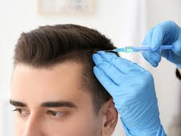 #Hair #Loss #Growth #Treatments and #Products #Market 2019-2026 | Request a sample Report @: bit.ly/2rXvaAk

Leading players: @Loreal , <a href="/Unilever/">Unilever</a>, <a href="/Taisho/">taisho</a>, <a href="/Henkel/">Henkel</a>, <a href="/Merck/">Merck</a> <a href="/Shiseido/">Shiseido Global</a> <a href="/Rohto/">rohto_c</a>, <a href="/Lifes2Good/">jacqueline odonnell</a> <a href="/Toppik/">Toppik</a>, <a href="/Nanogen/">NanoGen Technologies</a> <a href="/Bayer/">Bayer AG</a> <a href="/PharmaMedicoJob/">Pharma HealthcareJob</a> <a href="/Amplixin/">Amplixin</a>, <a href="/Kerafiber/">KeraFiber</a>