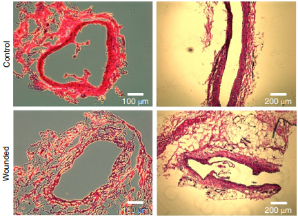 natBME's tweet photo. Lymphatic remodelling in response to lymphatic injury in the hind limbs of sheep
https://t.co/jNHFPUHP5I https://t.co/qlPo2hQW0c