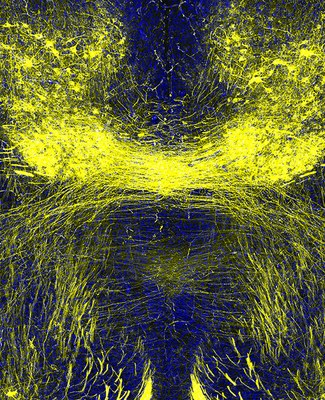 OoR_UNC's tweet photo. Dr. Eva Anton and team show how 2 gene mutations cause dysfunctional neuronal cilia that leads to #Joubertsyndrome -Related Disorders, showing that manipulation of these cilia may alleviate neuronal defects. More on this @Dev_Cell paper here https://t.co/ctS6dcqq0L #JSRD #neurons https://t.co/pebFGiJev5