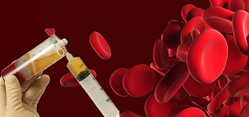OdulakDr's tweet photo. PRP Demonstrates Potential for Diabetic Peripheral Neuropathy Treatment: https://t.co/h7APzxqVAi #RegenerativeMedicineinNYC #PlateletRichPlasmaandPRPInjections https://t.co/prhj6VY73a