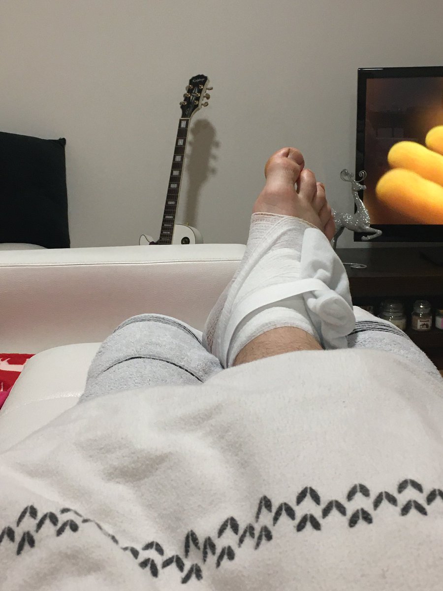 Patrig_Sherman's tweet photo. Alright, the #Leafs put me on LTIR (torn ankle ligaments, 5-6 weeks to recovery) but this doesn’t stop me from watching the game!

Wish you all the best during Christmas, in 2020 and of course go Leafs go! #LeafsForever #europeansquad 🇨🇿🇨🇦🏒 https://t.co/zhrPy6NC7d