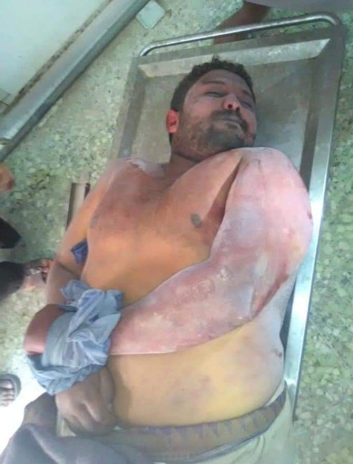 مقتل المواطن يسلم صالح سعيد حبتور داخل قسم  شرطة  جوله الريده  تحت التعذيب على يد قوات الأمن الخاصة في شبوة حيث قد تم اعتقال حبتور يوم امس الاحد في نقطة أمنية في جوله الريده على اهل  الظحية والمجلس الانتقالي يطالبون بالتحقيق  للجنة مستقلة في الواقعة، والمحاسبة الجناة المتورطين،