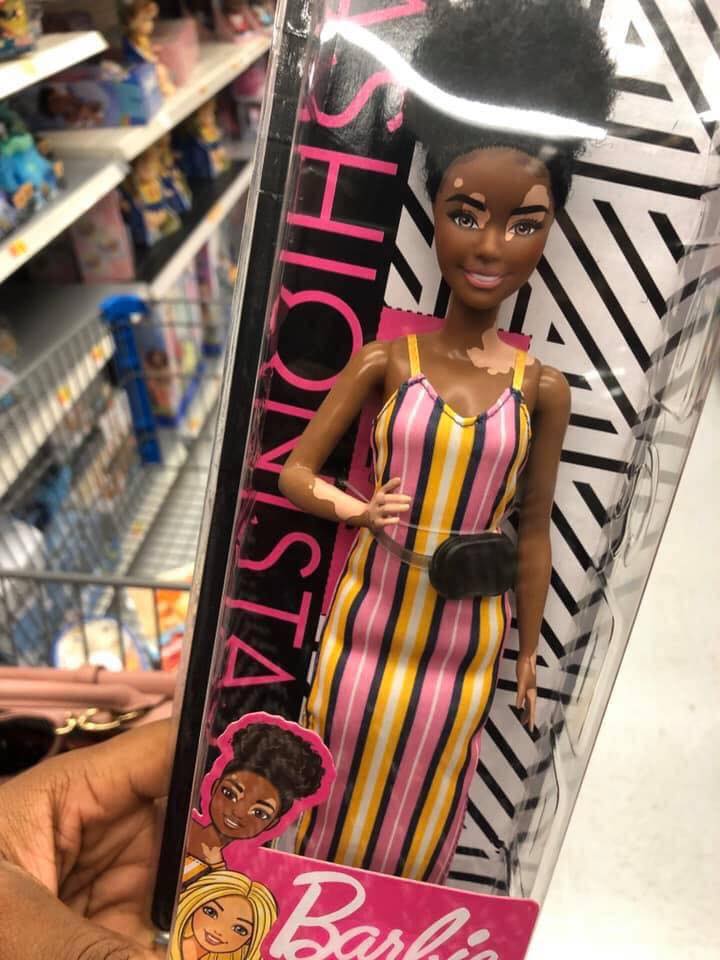 QuebrandoOTabu's tweet photo. Princesas também tem vitiligo.

Inclusão faz toda diferença! ♥️✊🏾 https://t.co/9oFYXhygmd