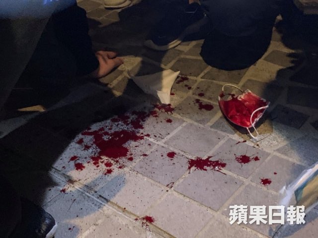#HKPoliceTerrorists fired rubber bullets horizontally. A man got shot in nose and heavily bled. Aiming at people’s head has become common practice of police terrorists and they don’t care if somebody may be severely injured. Photo: Apple Daily