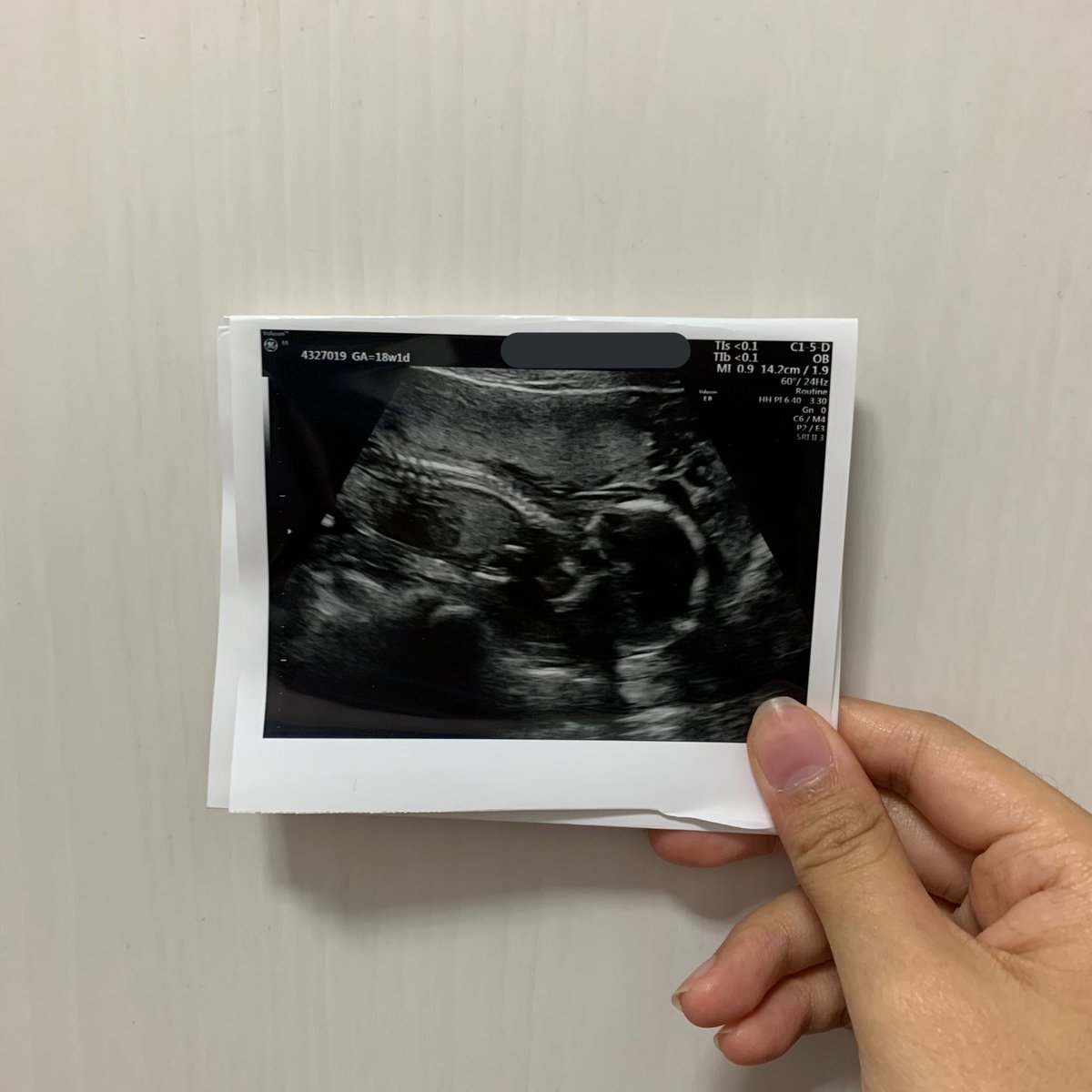 tkdviaaa's tweet photo. 今年一番最高のプレゼント👶🏼❤️✨ https://t.co/KHjotDDvS0