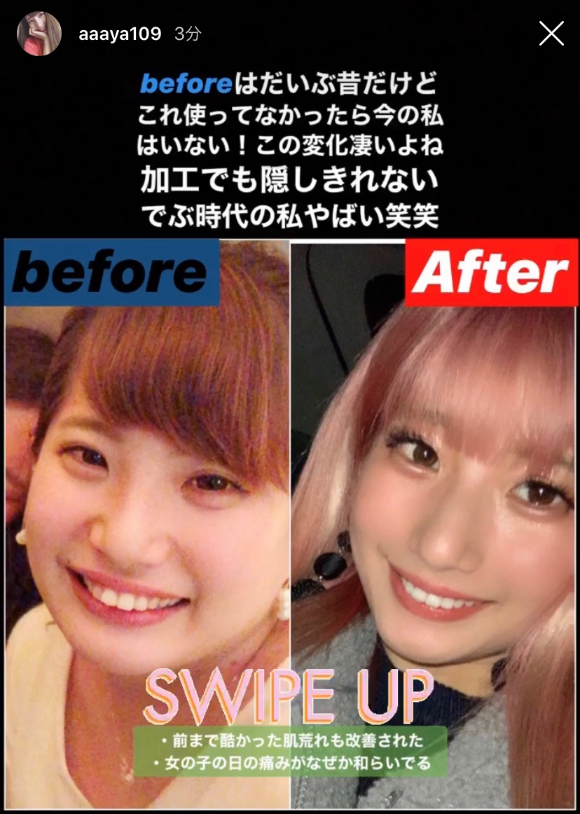 ポリエステル Afterの写真 こんな加工しまくりの写真をafterに使って詐欺にならないの 写真加工ならラクビ使わなくても誰でも痩せれるしお目目だってでかくなるし 顔も小さくなるしお肌もツヤツヤになるよ 目の大きさ倍以上違うし 加工しまくり