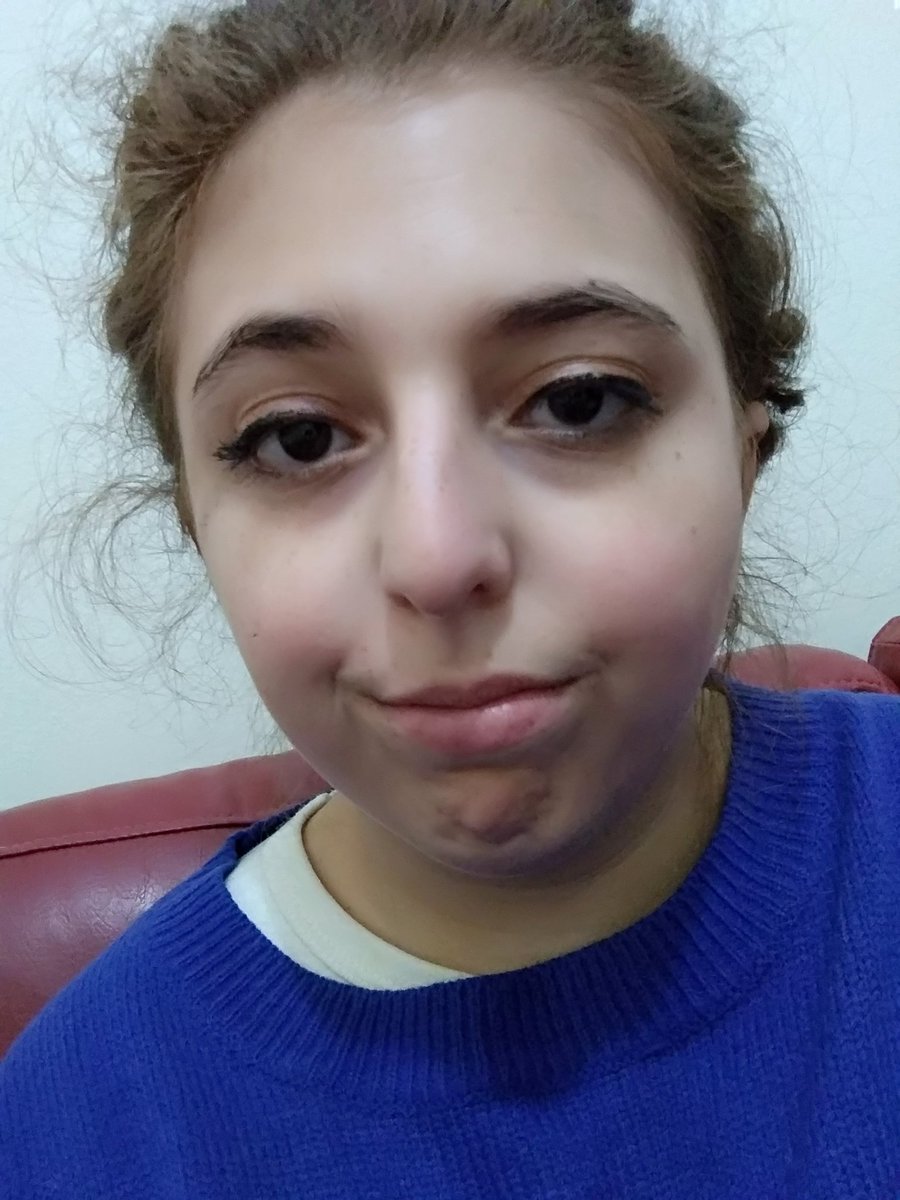 Coral_Lazarof's tweet photo. Can you sue someone for making you cry and ruin your makeup? Because this is how I look like after finishing ep.13 of #MrRobot
#uglycrying #GoodbyeFriend #helloelliot @samesmail @esmailcorp @ItsRamiMalek @carlychaikin @PortiaDd @ChristianSlater https://t.co/LUqsst2b54