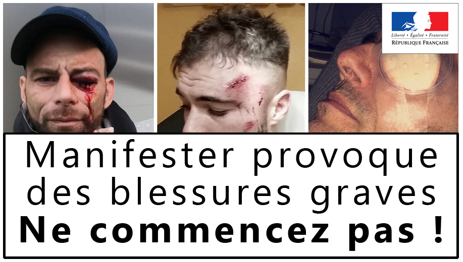 LucioleAntiC's tweet photo. Le Gouvernement lance une campagne de prévention
#Acte21 #Acte22 #ActeXXI #ActeXXII #Blessure #Castaner #GiletsJaunes #Police #Violence
https://t.co/jnHMjGSfvf https://t.co/ATqRioW87N